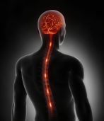 What Are the Different Types of Spinal Cord Injuries?