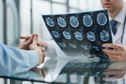 Charlottesville Brain Injury Lawyer