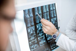 Charlottesville Spinal Cord Injury Lawyer