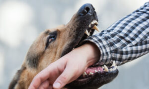 When Should You Go to the Doctor for a Dog Bite?