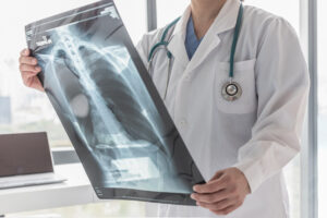 Types of Back Injuries